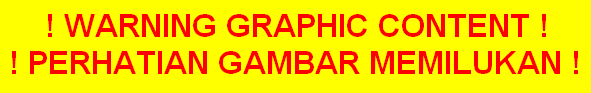 warning graphic content / gambar memilukan
